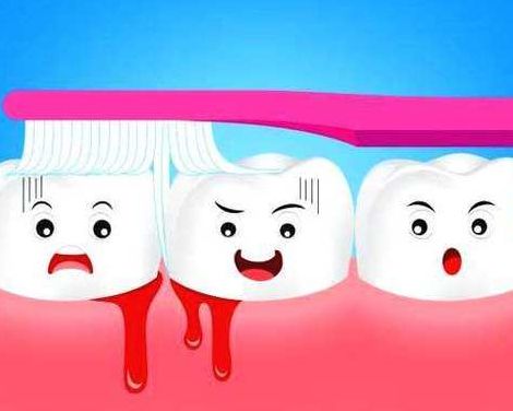 刷牙出血是什么原因（径常刷牙出血是什么原因）