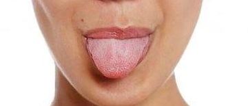 舌头发麻是什么原因（舌头发麻是什么病的前兆）