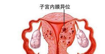 子宫内膜增厚是什么原因造成的（子宫增大子宫内膜增厚是什么原因造成的）