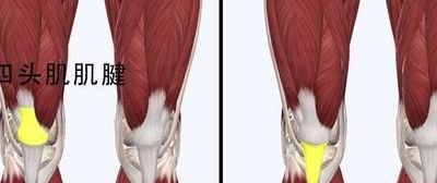 肌肉酸软（大腿靠近膝盖的肌肉酸软）