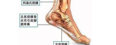 脚后跟疼痛是什么原因怎么治疗呢（脚后跟疼是什么症状,该怎么治疗?）
